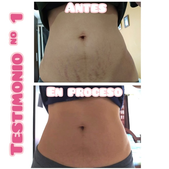 Meet your Posher, MB Distributor, LLC - Picture 13 of 17